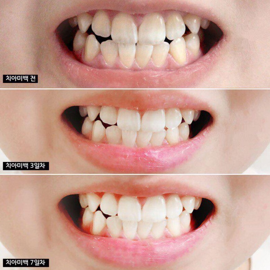 MEDIAN Whitening Science Toothpaste 100g Real effective brightening toothpaste