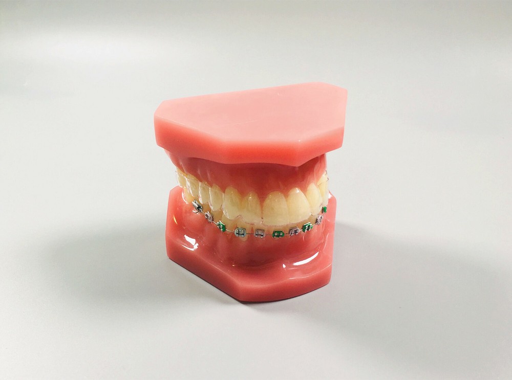 1Pc Dental Model Invisible Retainer Metal Brackets Contrast Aligner Comparison