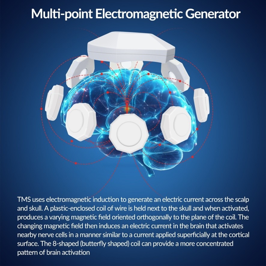 Transcranial Magnetic Stimulation Portable rTMS Device Adjustable Magnetic Field