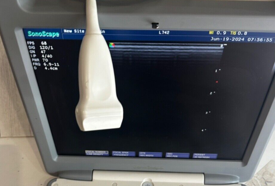 SonoScape Transducer L742 LinearArray Probe for S Series Ultrasounds