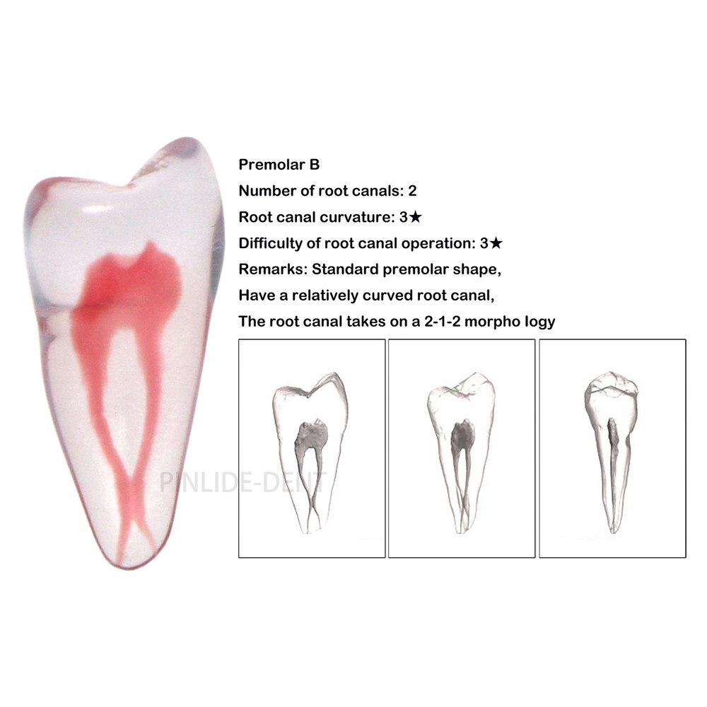 Dental Resin Root Canal Teeth Model Endo Practice Block RCT Pulp Cavity Study