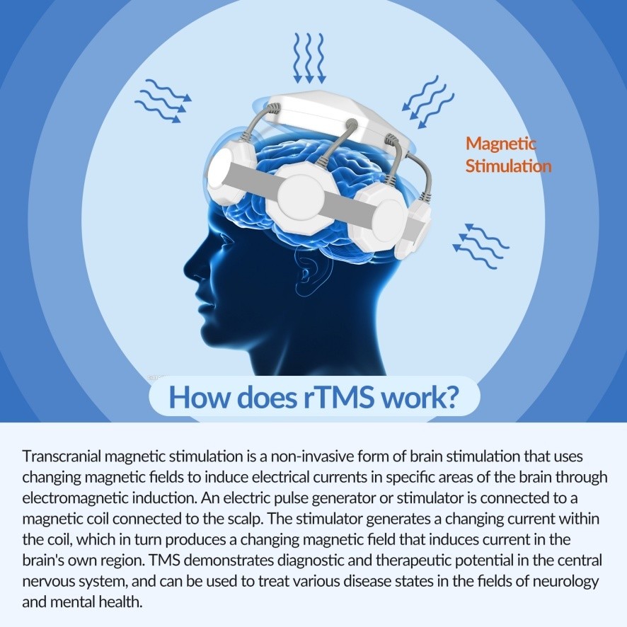 rTMS Device for Stress Reduction & Sleep Improvement Low Field Setting