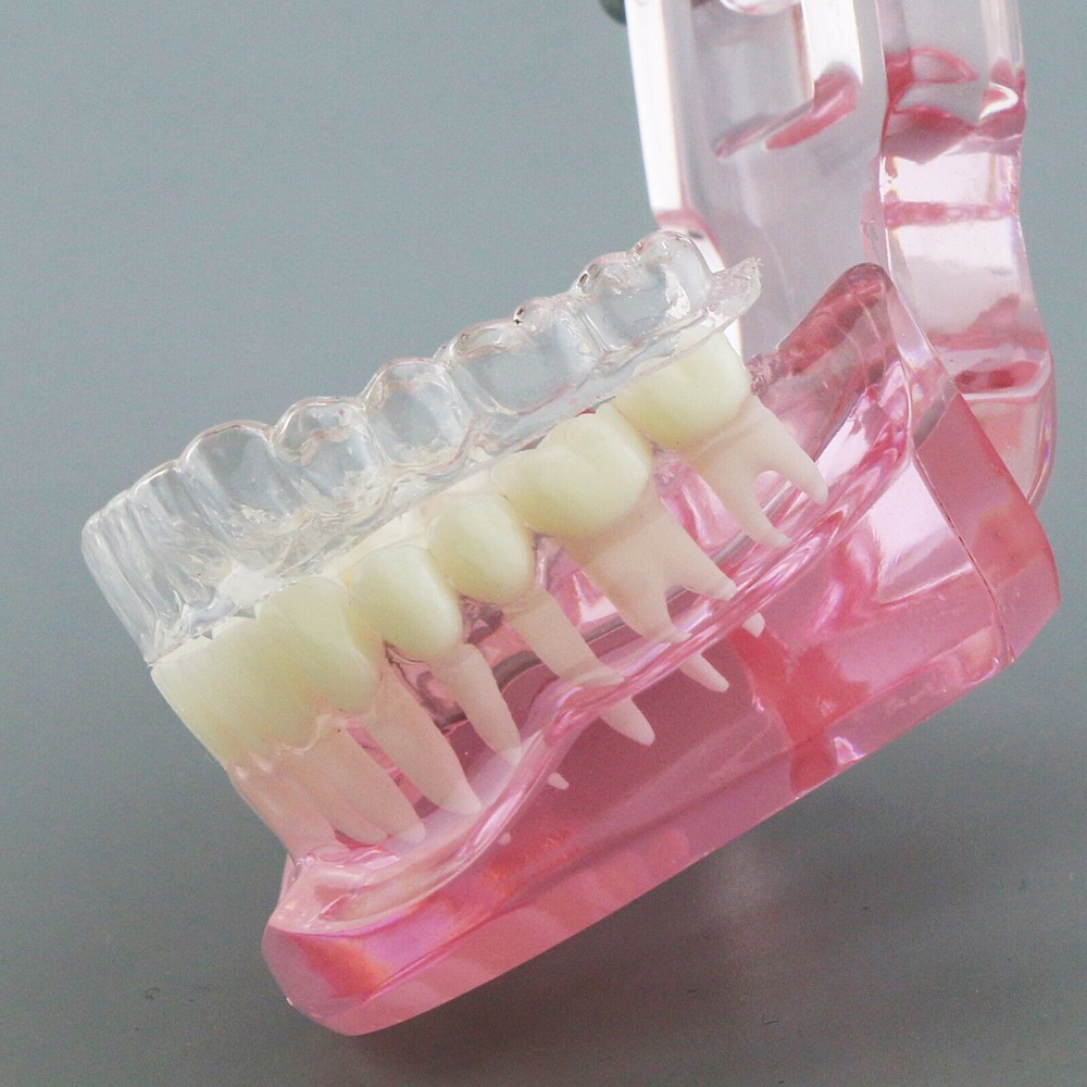 Dental Typodont Model Self-ligating Metal Bracket Ceramic Transparent Retainer