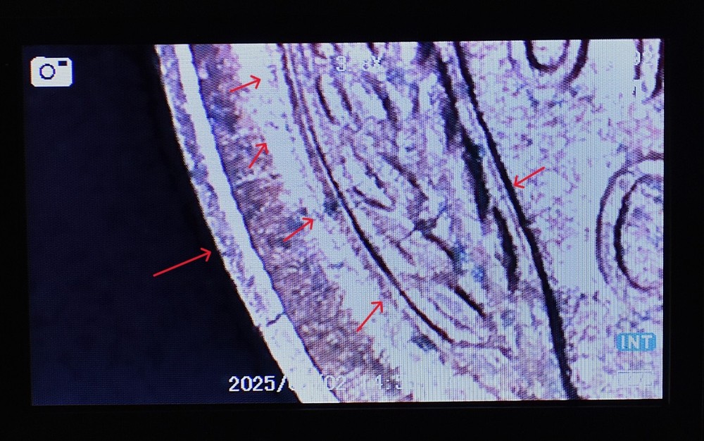 1949 D Penny Error Red Mint State Multi Error Double Die, Cracks Collar Filled D