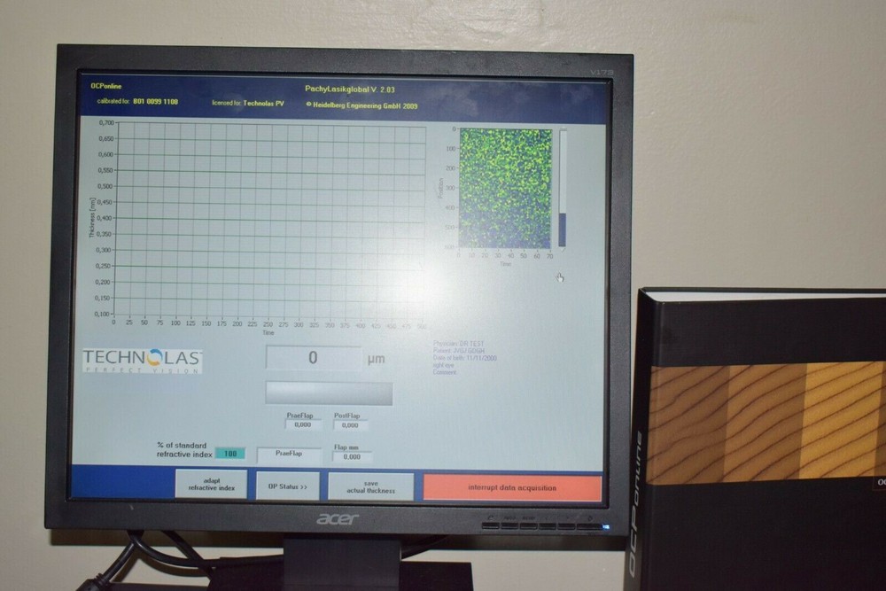 Heidelberg intraoperative pachymeter /thickness gauge using OCT