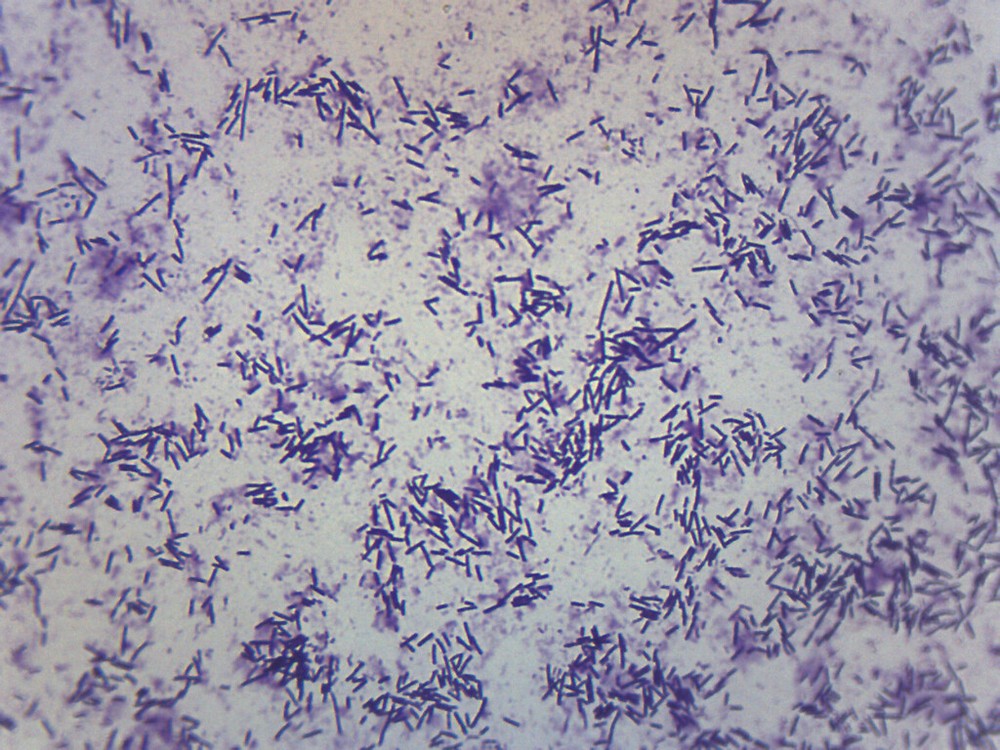 Escherichia Coli Smear, Prepared Microscope Slide - 75x25mm - Eisco Labs