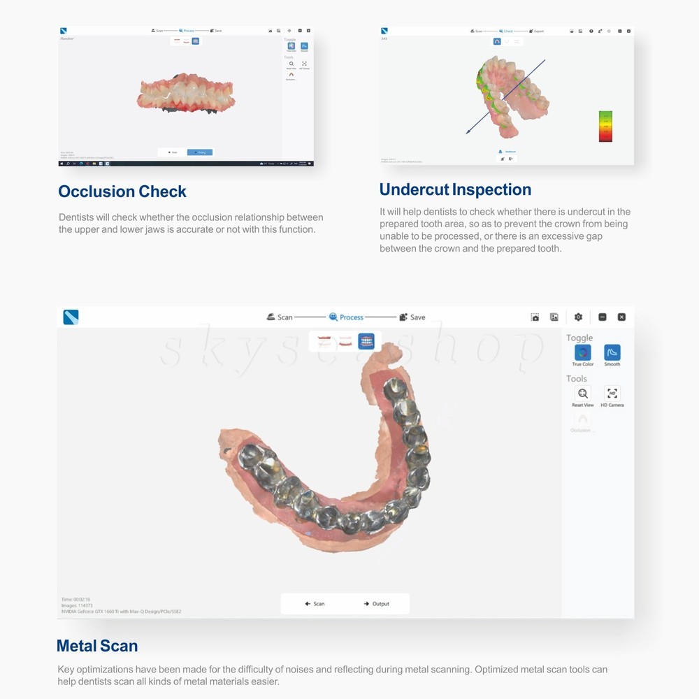 Dental Intra-oral 3D Scanner With Free Software CAD CMD Updated