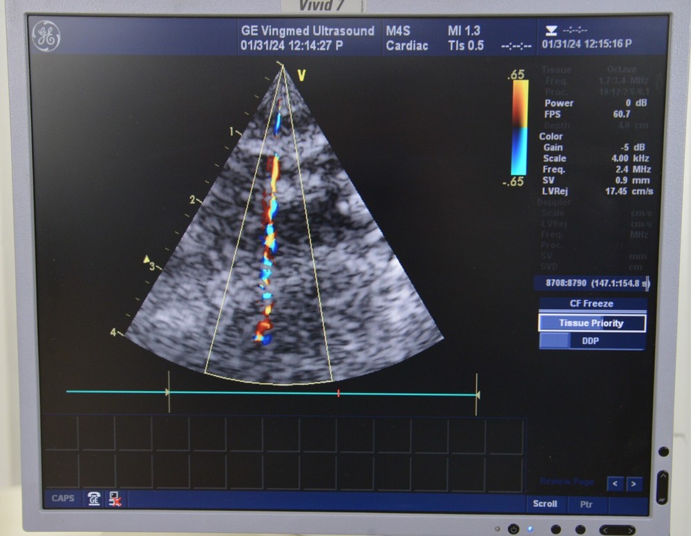 GE M4S Cardiac Sector Array 5129041