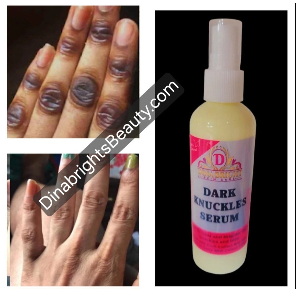 Dark Knuckles/ Knee/Elbow Remover serum