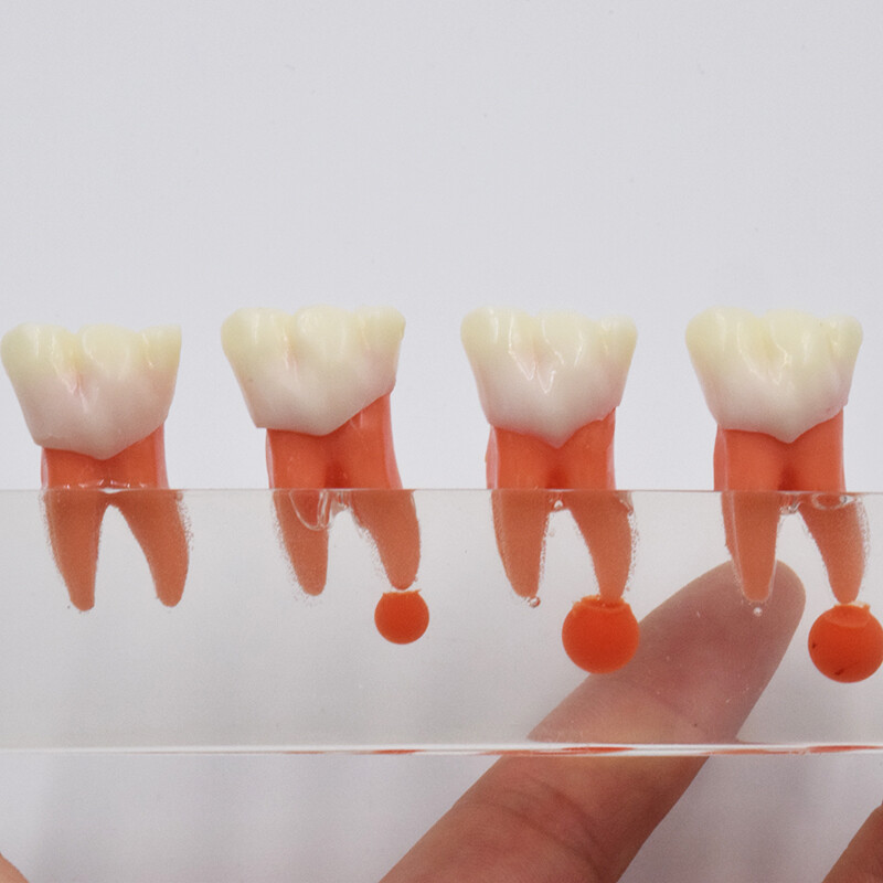 Dental Study Teaching Model Periodontal Caries Disease Teeth Dentoform Typodont
