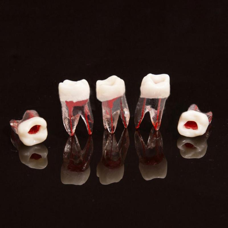 Dental Teeth Root Canal RCT Block Pulp Cavity Practice Model for Endo File Study