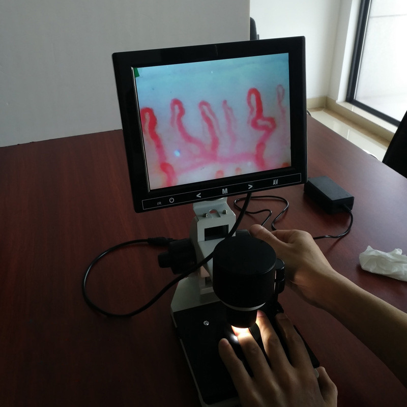 Digital Microscope Terminal Microcirculation Detection Nail Wall Observe Screen