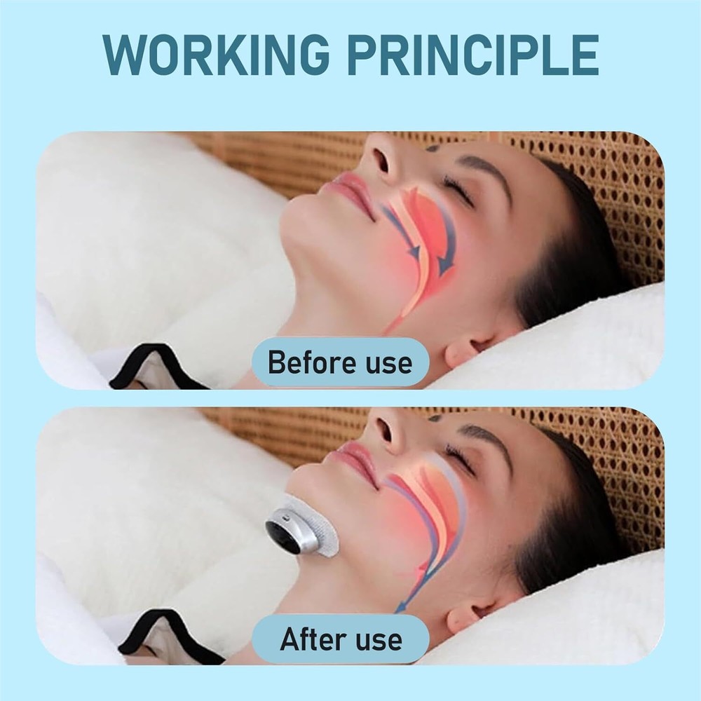 Professional Anti-Snoring Device, 3-Speed Adjustment, Smart Snoring Solution US