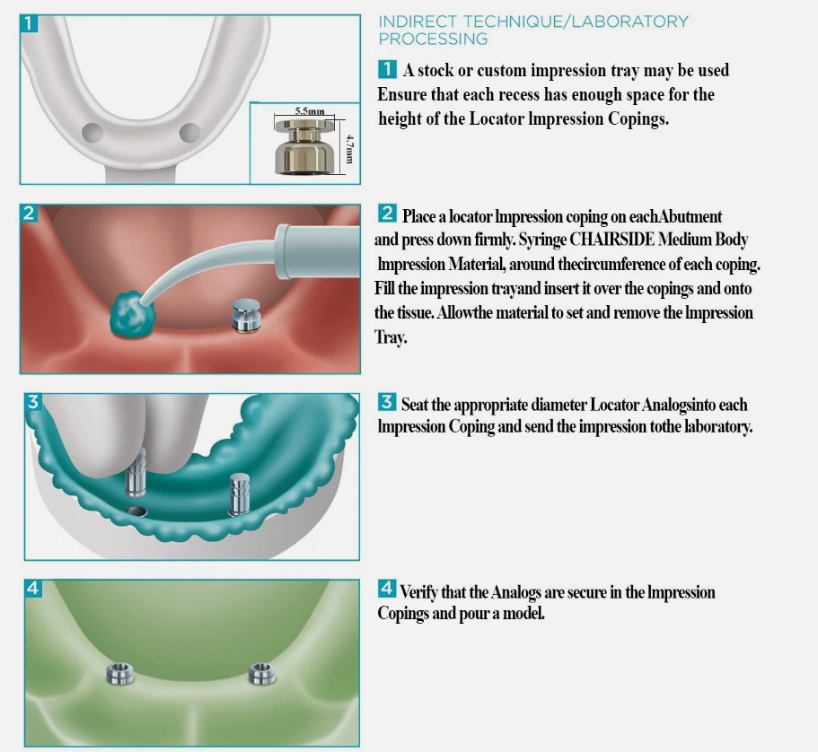 Dental Closed tray locator impression coping W/Black Processing Insert fit ZEST