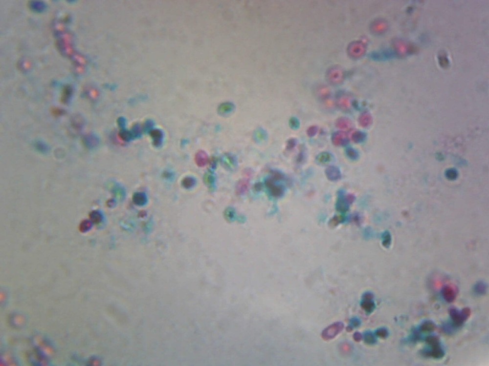 Saccharomyces Cerevisiae, Budding Cells; Whole-mount