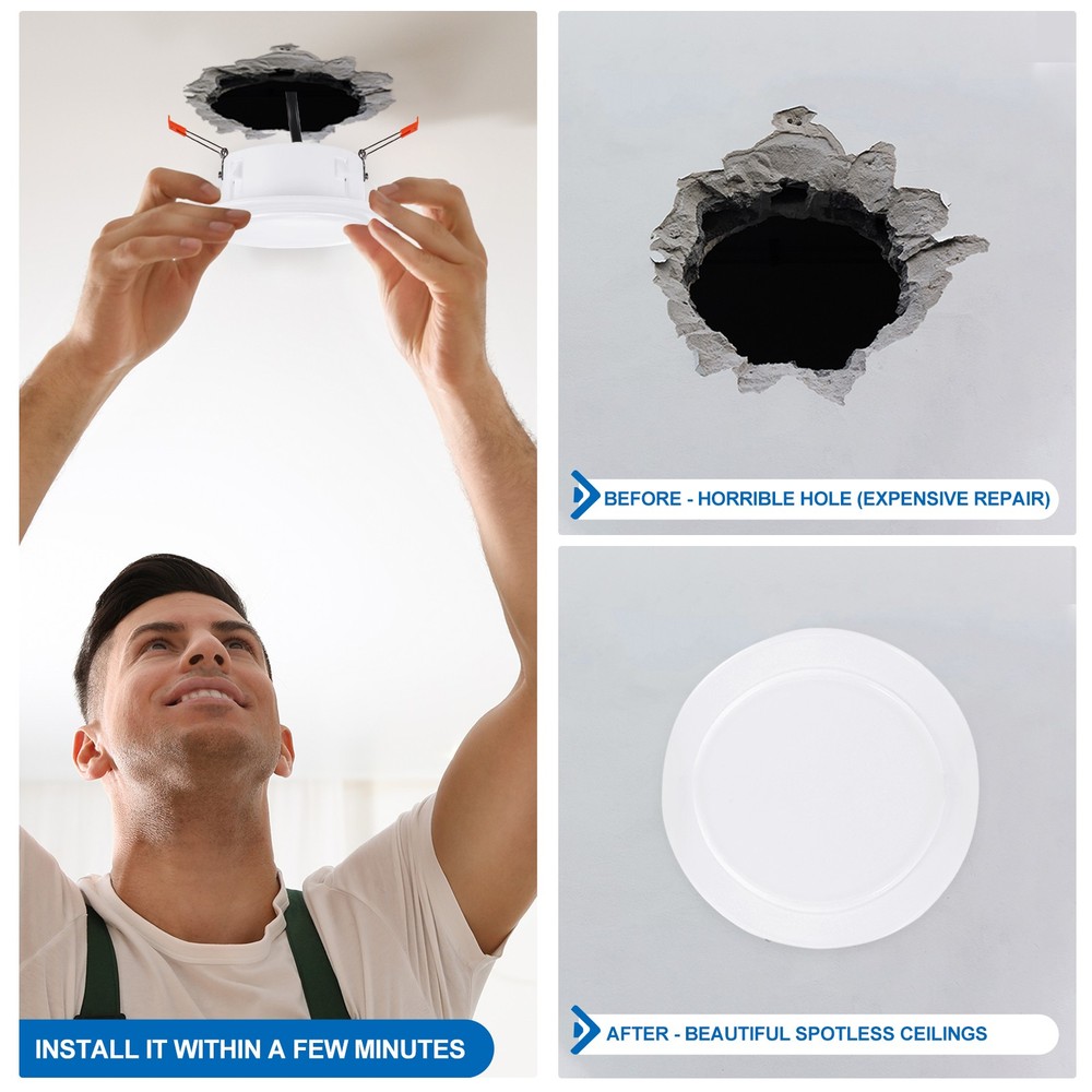 2Pack 4.5" Spring Ceiling Cover Plate Suitable for 3.5-4.1" Round Hole, White