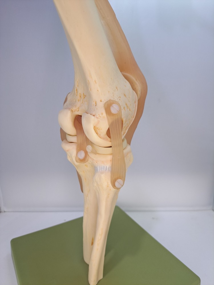 Vintage 1995 Somso Anatomical Model Functional Knee Joint Model BIN86