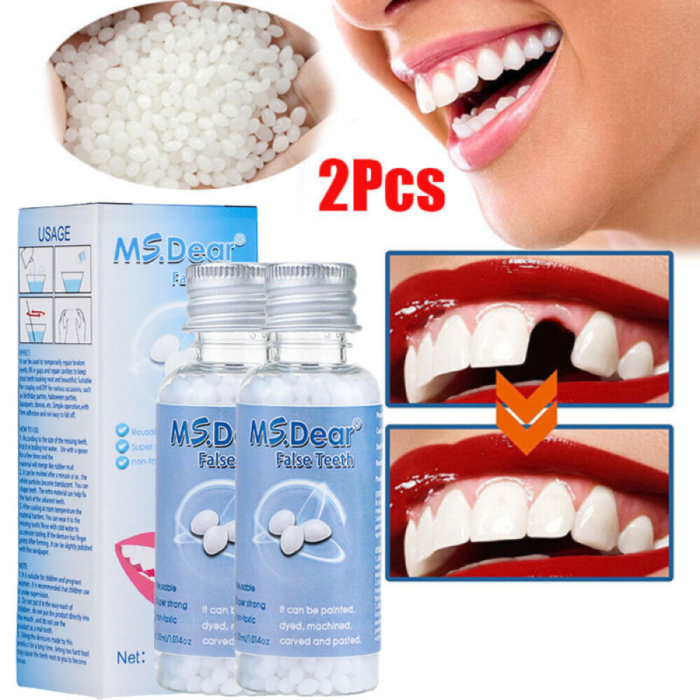 2X Temporary Missing Tooth Repair Kit Teeth And Gaps Solid Glue Denture Adhesive