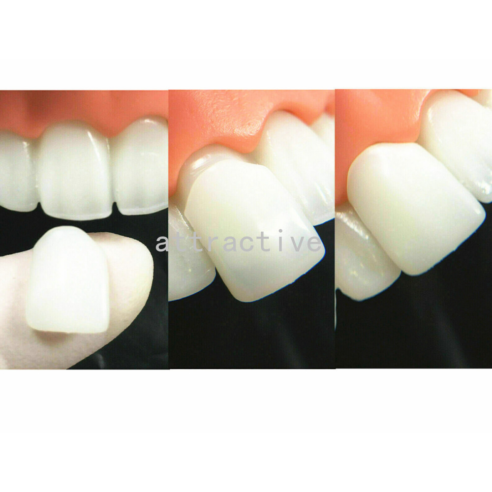 Dental Composite Veneer Template Model Practise Veneers Dentist Teaching 1Set