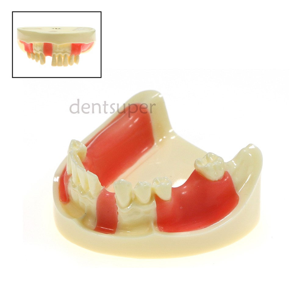 Dental Multiple Types Teaching Teeth Model Typodont Ortho Implant Practice Demo