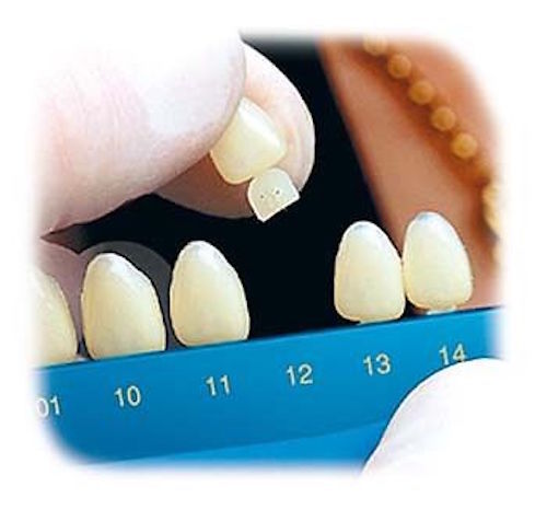 Dental Polycarbonate Temporary Crowns  5 pcs #33