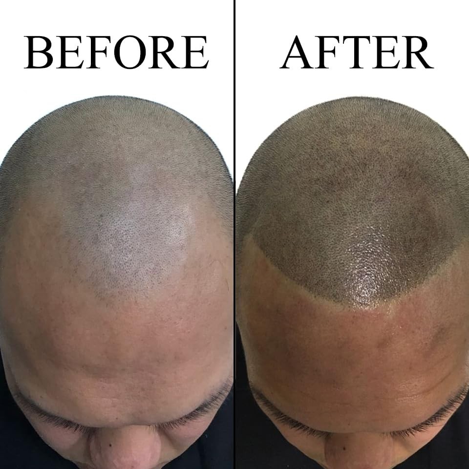 Nuva Scalp Micro-Pigmentation Ink - Customizable, Neutral Undertone for SMP P...
