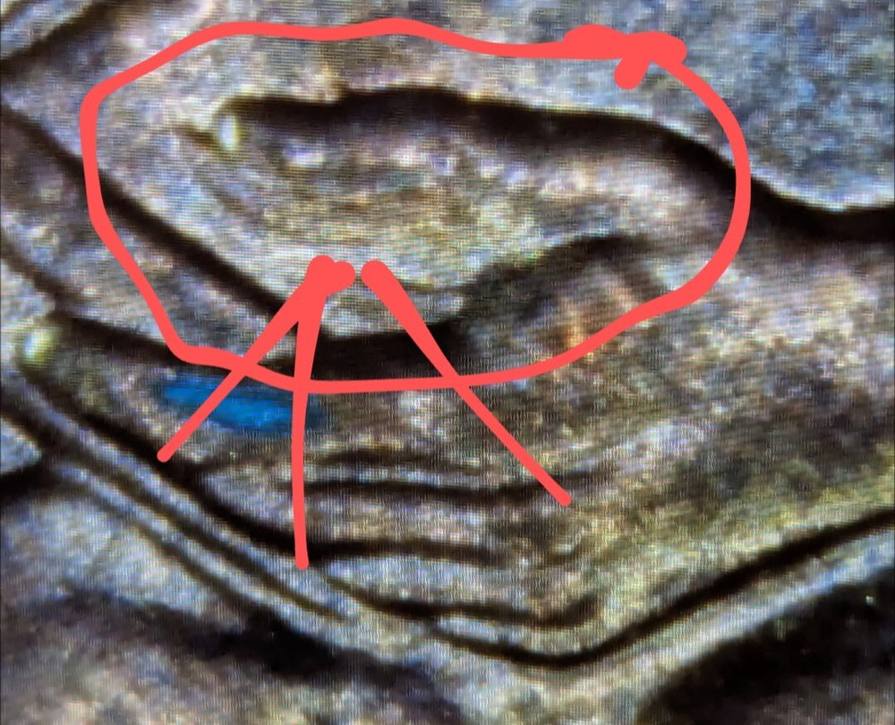 #1. Extra Finger Error 2009 Informative Years
