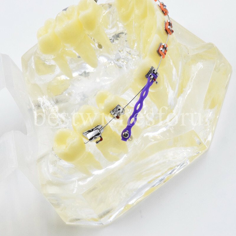 Dental Malocclusion Treatment Teeth Model Study Typodont Elastic chain 3005-2