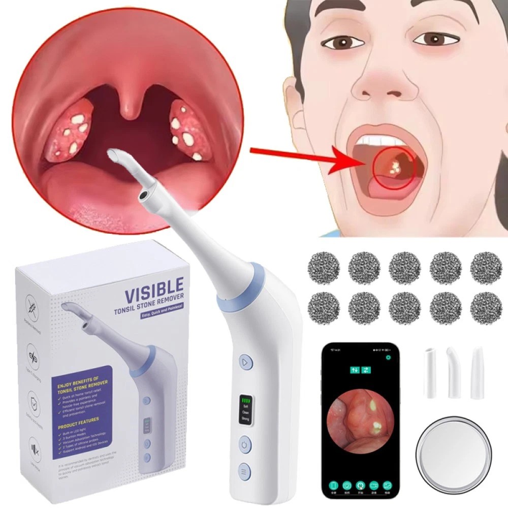 Electronic Tonsil Stone Remover Kit with LED Light & 3 Adjustable Suction Modes