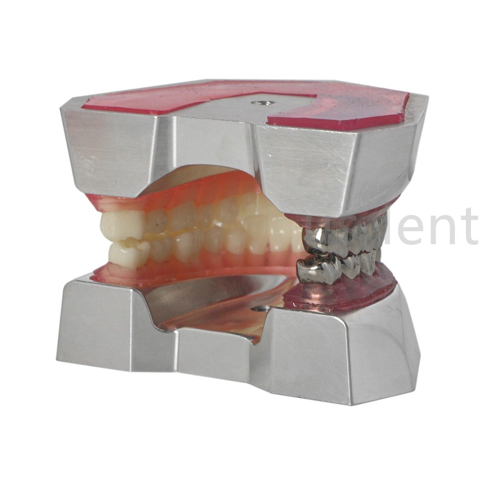 Dental Teeth Model With Restoration Learning and Teaching Demonstrate M6004