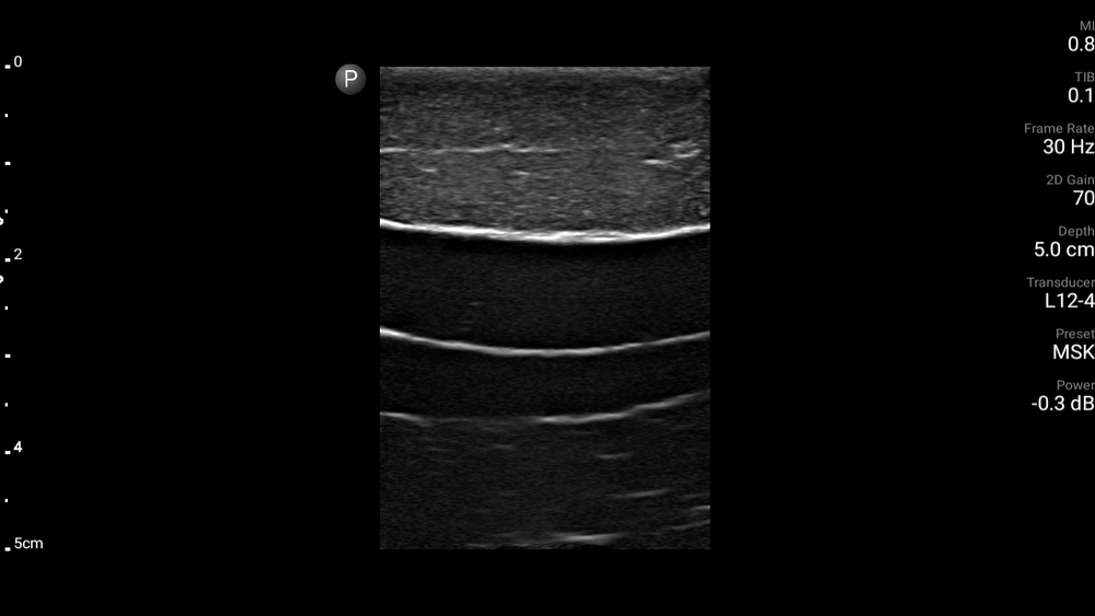 Internal Juglar ultrasound phantom -CVC (FLUID FREE)