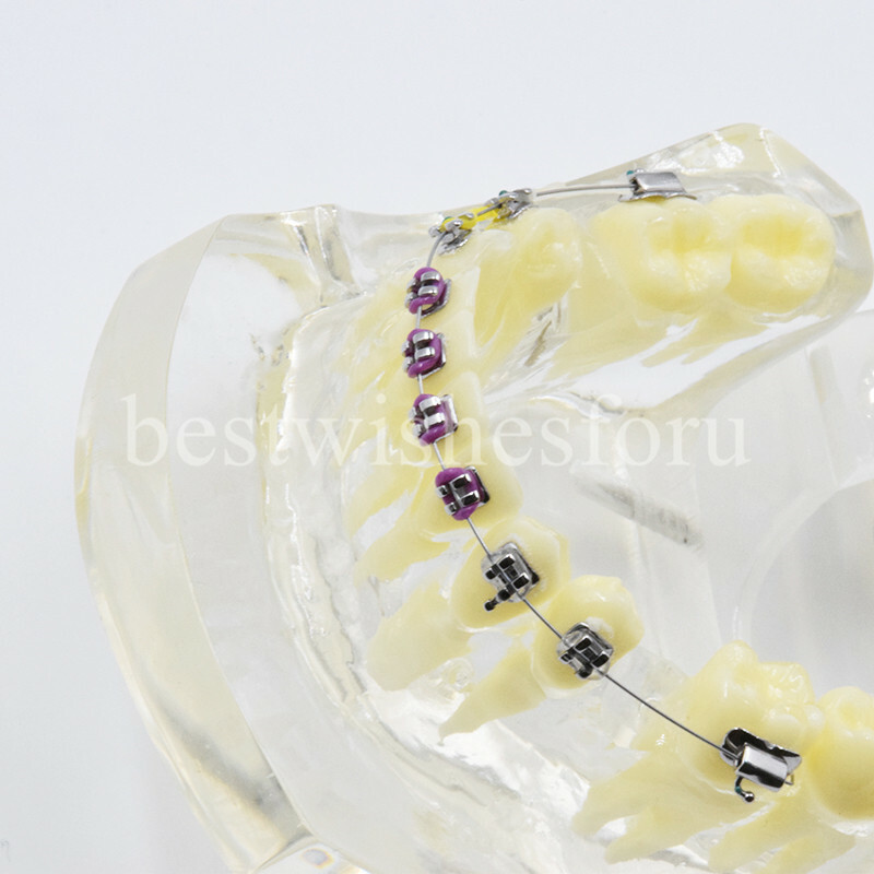 Dental Malocclusion Treatment Teeth Model Study Typodont Elastic chain 3005-2