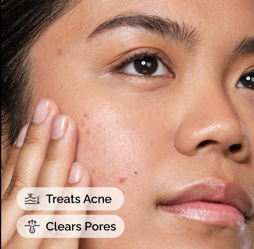 The Acne Set Ordinary