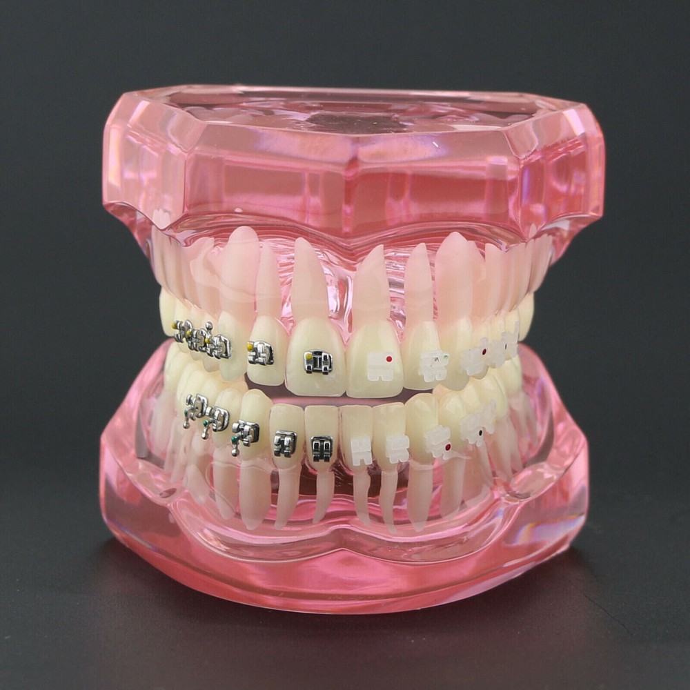 Dental Orthodontic Demonstration Ceramic and Metal Bracket Study Typodont Model