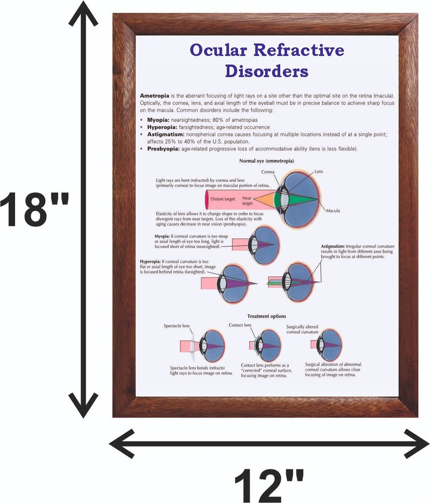 Ocular Refractive Disorders Chart 12x18 inches