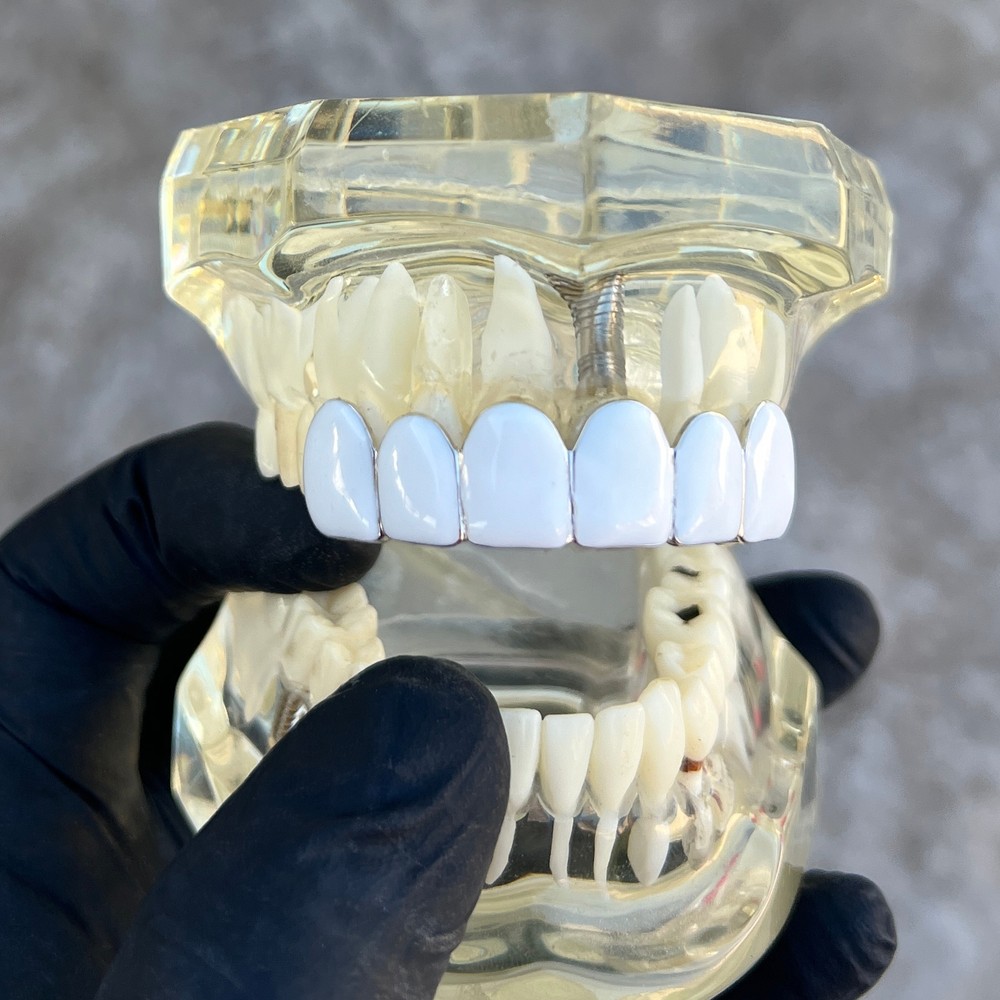 Real Solid 925 Sterling Silver White Enamel Grillz Rapper Grill Six Top Teeth