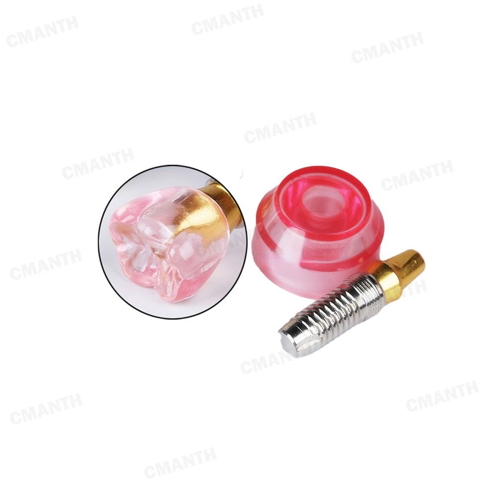 Dental Implant Model Demonstration Teeth Study Teach Model Detachable M2020