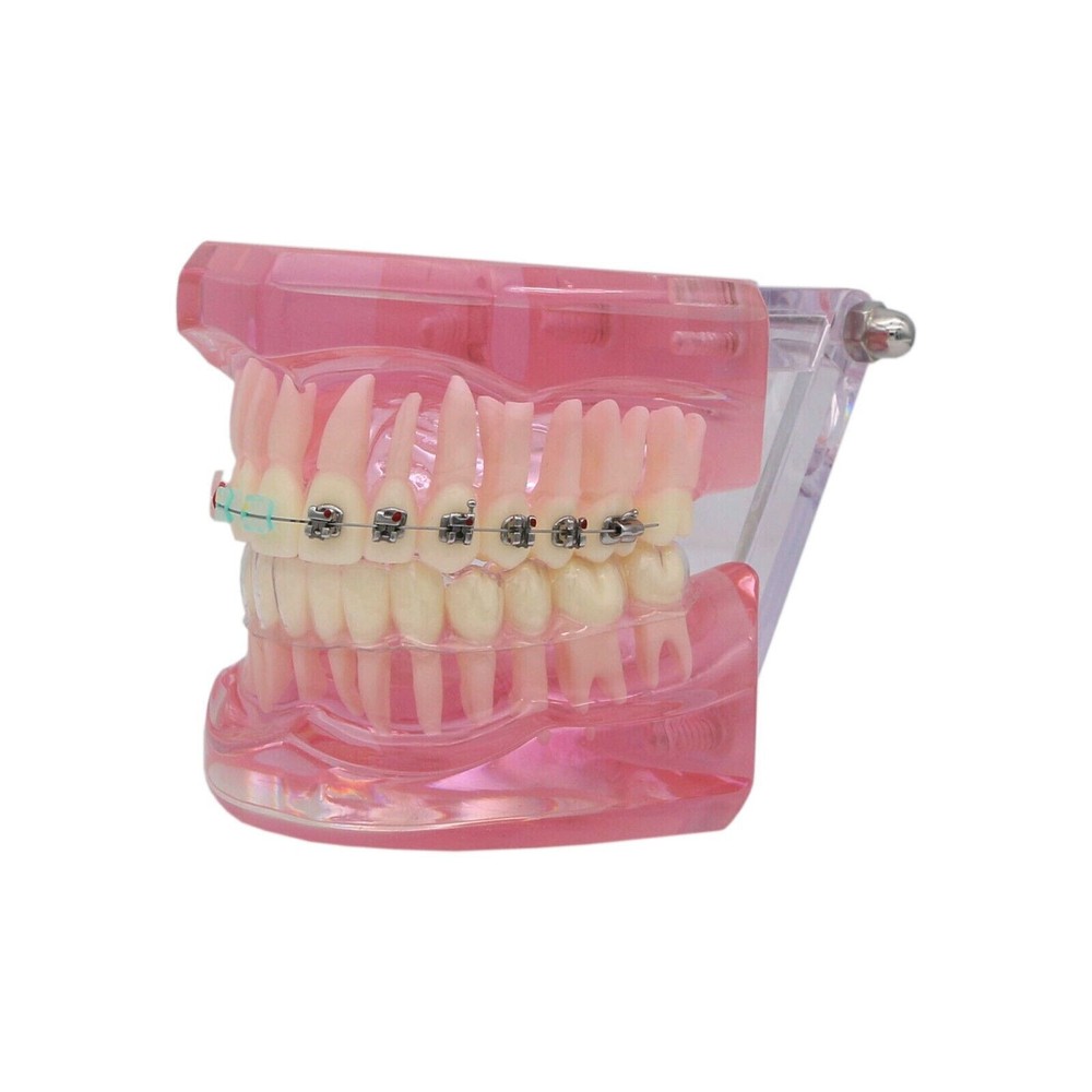 Dental Typodont Model Self-ligating Metal Bracket Ceramic Transparent Retainer