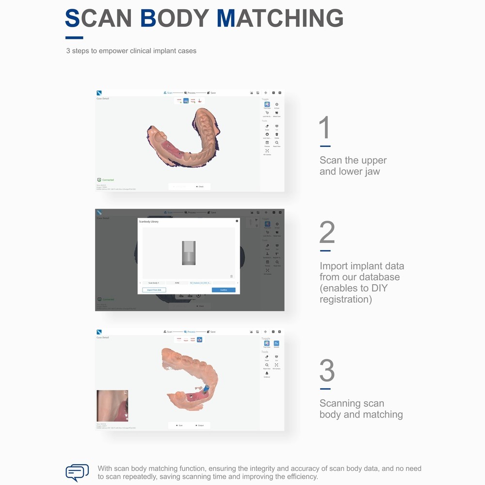 Digital Intraoral Dental Scanner + Scanning Tip & USB Cable