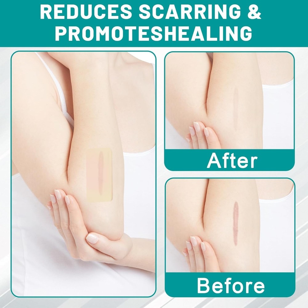 Hydrocolloid Roll, Extra Large Hydrocolloid Bandages, Pimple Patch Roll for Acne