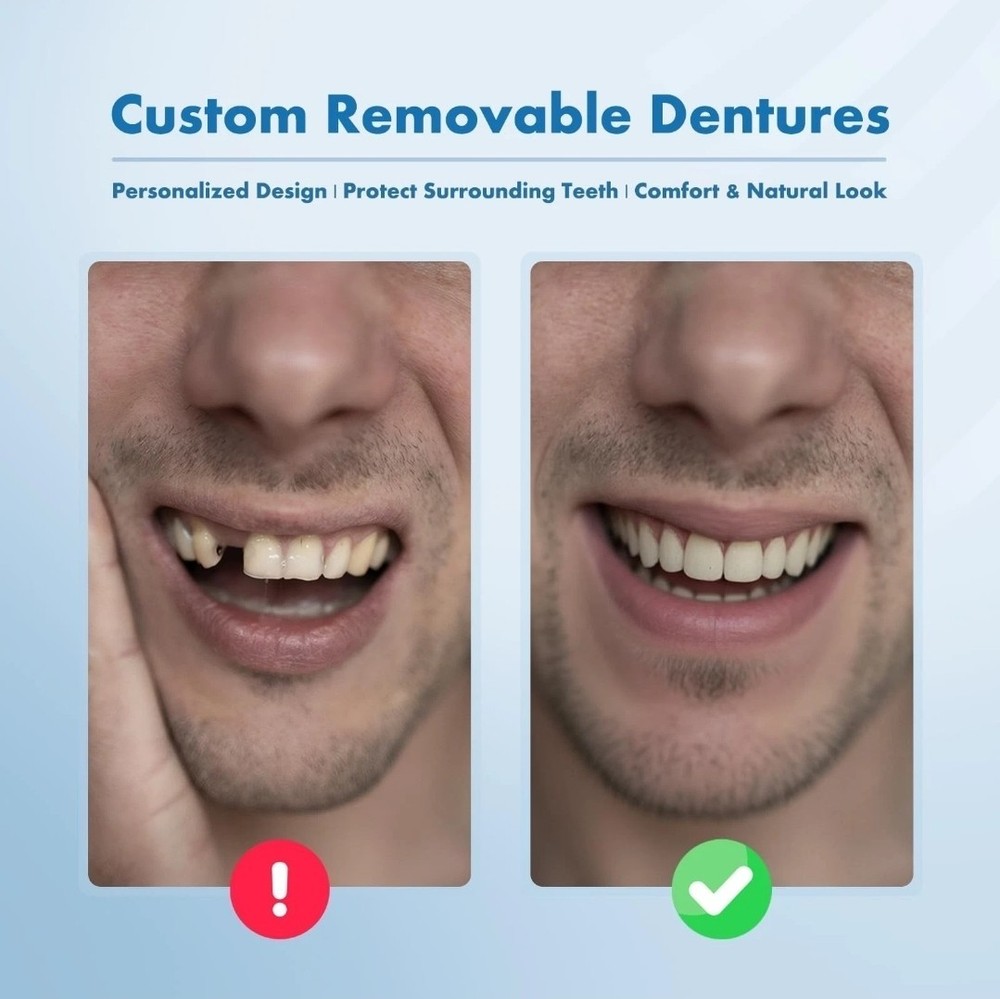 Qiivosm Removable Dentures Personalized Partial Denture Set for Tooth Replaceme