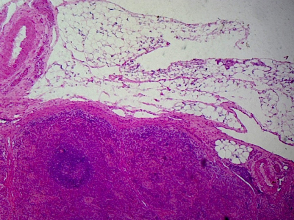 Spleen, Mammalian; Section; H&E Stain