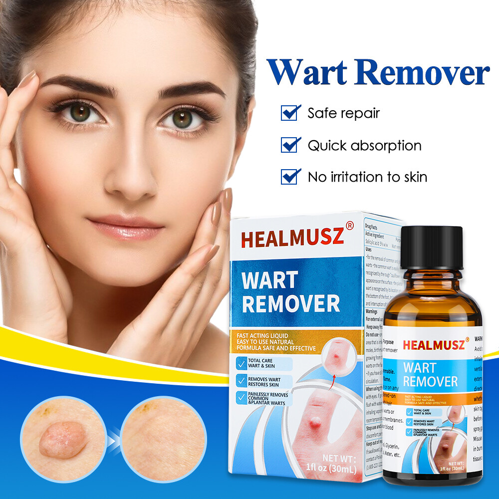 2Pack Wart Remover Liquid Skin Tag Mole Remover Eliminate Feet Corn Wart Remove