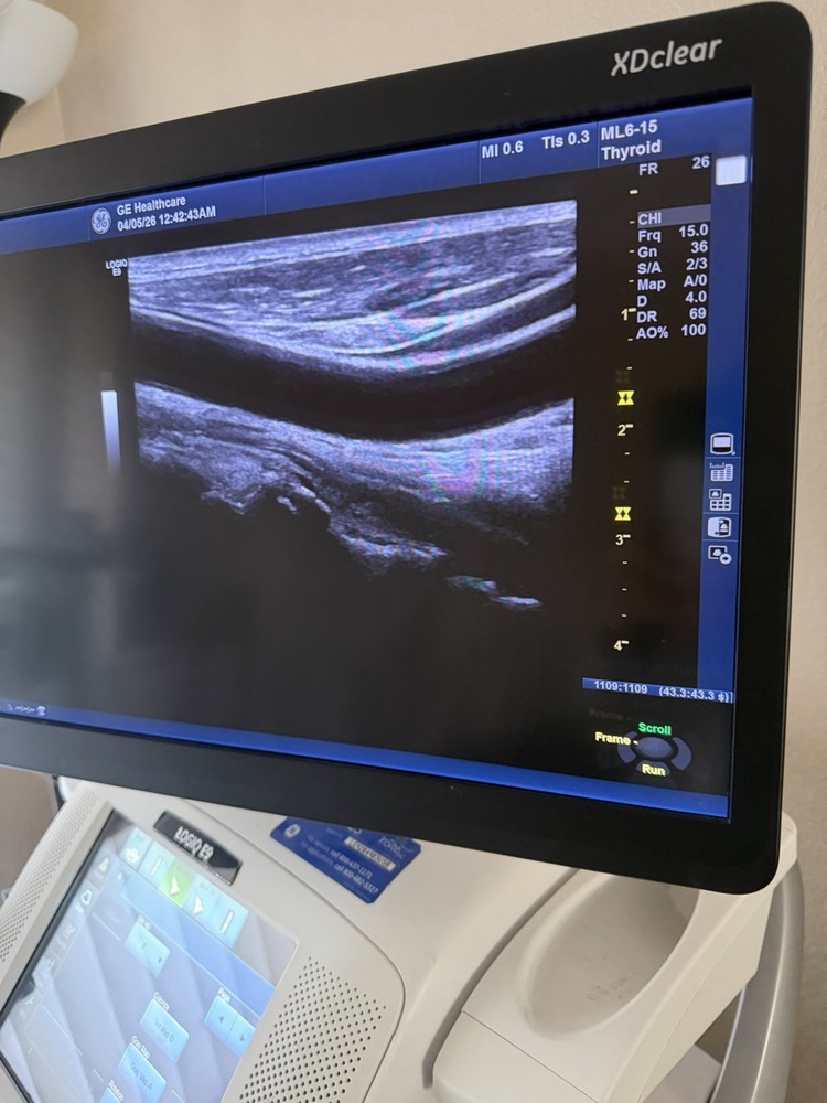 GE ML6-15 D Linear Vascular Probe , Excellent working condition,