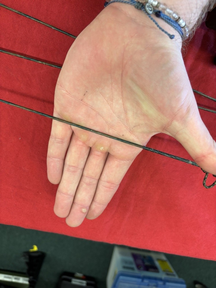 2005 Bowtech Extreme VFT| 25-30 DL| Cracked Bottom Limb