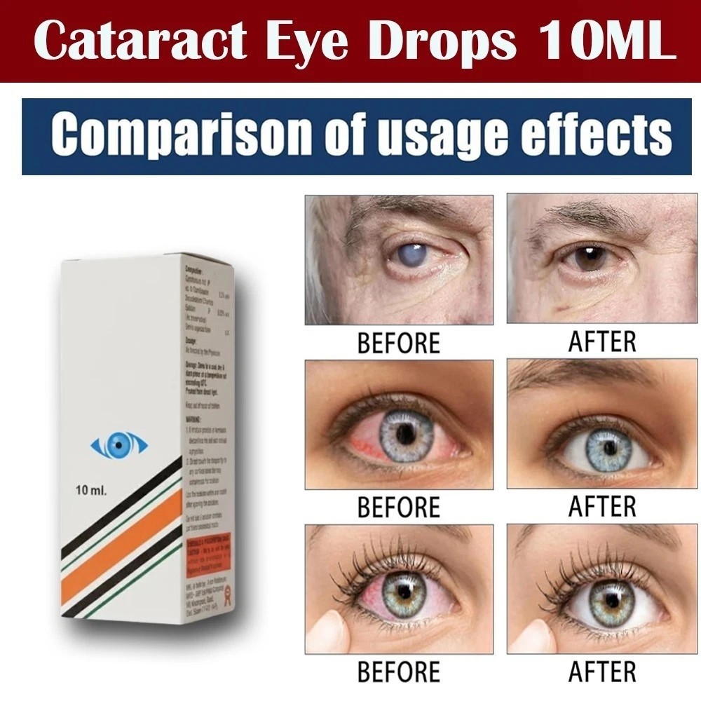 Bright Eyes Drops for Cataracts 2 PACK