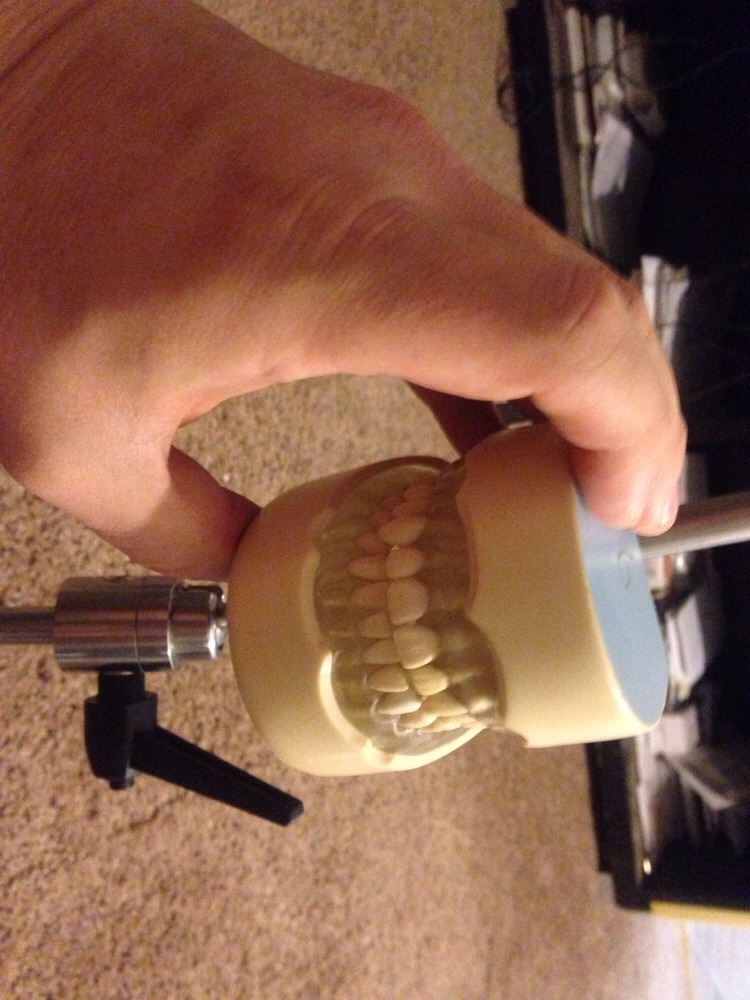 Dental Typodont Mounted On A Pole