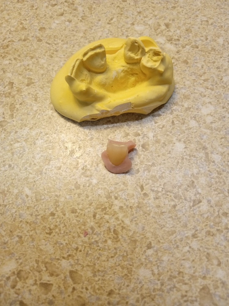 DIY Nesbit Partial w/Case,  Give Us Your #'s  See Full DESCRIPTION before buying