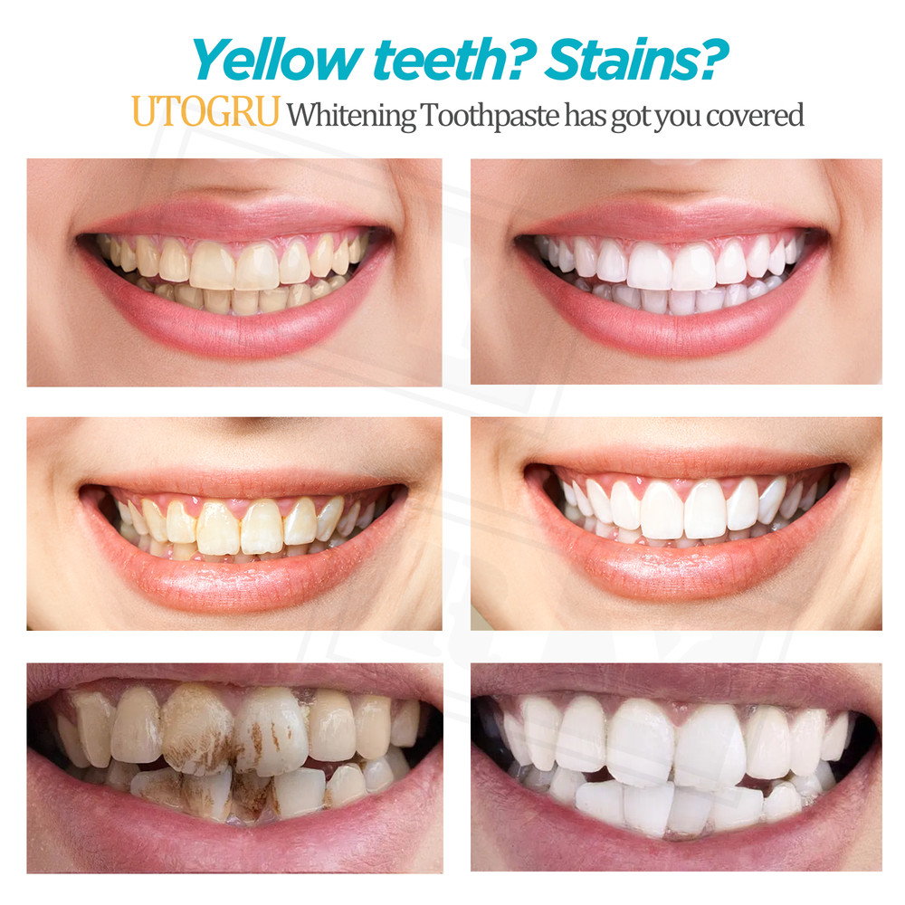 Whitening Toothpaste Natural Niacinamide Toothpaste Teeth Whitening Toothpaste