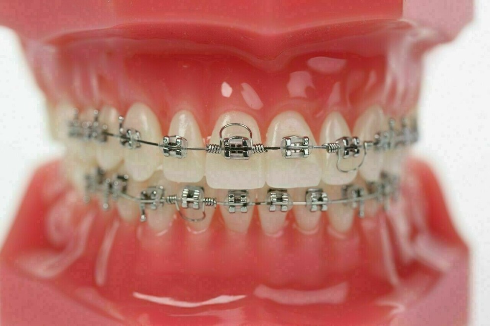 20 Packs Dental Orthodontic Anterior Teeth Torque Spring Rectangular Arch Wire
